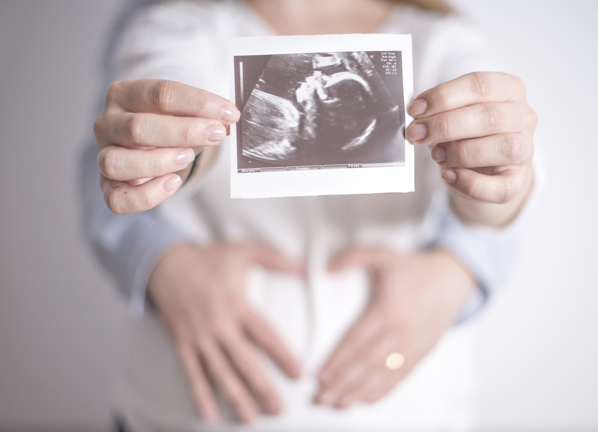Woman holding an ultrasound image, representing pregnancy scans and monitoring at Phoenix Women’s Health.